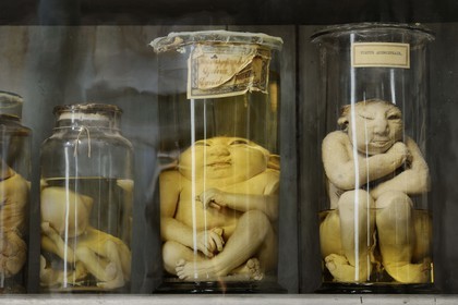 France, Hérault (34), Montpellier, centre historique, faculté de médecine, le musée d'anatomie, foetus de la collection de tératologie qui est l'étude scientifique des malformations congénitales